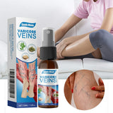 South Moon Varicose Veins Treatment Spray – 35ml Advanced Formula For Spider Veins, Leg Pain & Swelling Relief | Natural Herbal Spray For Better Circulation