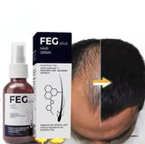 FEG PLUS Hair & Beard Regrowth Spray – Anti Hair Loss Formula With Minoxidil, Redensyl & Natural Extracts (50ml)