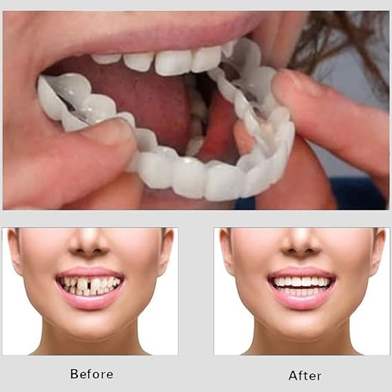 Snap On Smile - Veneers Teeth For Men And Women - Moldable False Artificial Braces Teeth