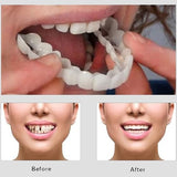 Snap On Smile - Veneers Teeth For Men And Women - Moldable False Artificial Braces Teeth