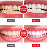 Yayashi Sp-4 Ultra Whitening Toothpaste Probiotic Stain Remover Stain Removing Toothpaste, Protects Gums Freshens Breath, For Everyone