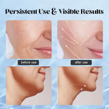 Massager For Face Lifting Facial Massagers EMS Neck Eye Massage Instrument Vibrator Microcurrents Red Light Therapy Anti Wrinkle - Random Color