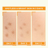 Garnier Skin Naturals Vitamin C Booster Serum 30ml – Bright Complete 30x Vitamin C Formula For Glowing, Spot-Free, And Radiant Skin