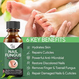 Fast Nail Fungus Treatment Gel – Nail Repair Essence Serum For Healthy, Smooth & Strong Nails