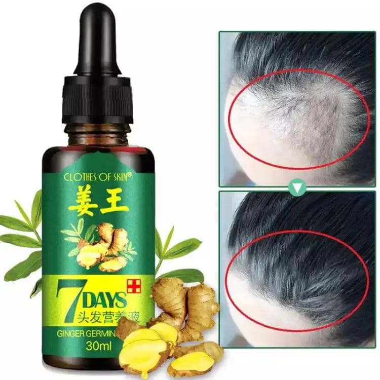 Original 7 Days Hair Growth Germinal Serum Oil (30ML)