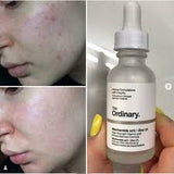 The Ordinary Niacinamide 10% + Zinc 1 % - 30ml