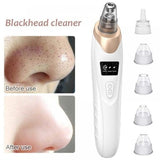 Electric Blackhead Remover | Vacuum Acne & Pore Cleaner | 5 Heads Suction Machine | Skin Care & Exfoliating Tool