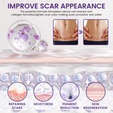 Timilk Regenscar Stem Cell Scar Gel 20g Triple Action Formula For Old And New Scars Surgical Marks Skin Renewal