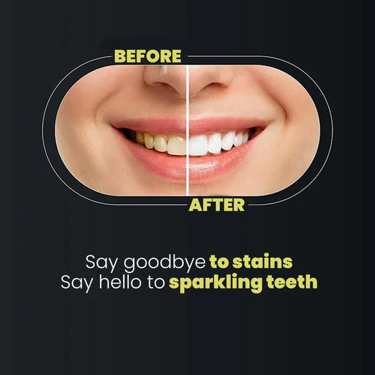 Teeth Whitening Strips 9D Advanced Professional Stain Removing Enamel Safe Bright Smile Treatment 14 Strips