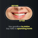 Teeth Whitening Strips 9D Advanced Professional Stain Removing Enamel Safe Bright Smile Treatment 14 Strips