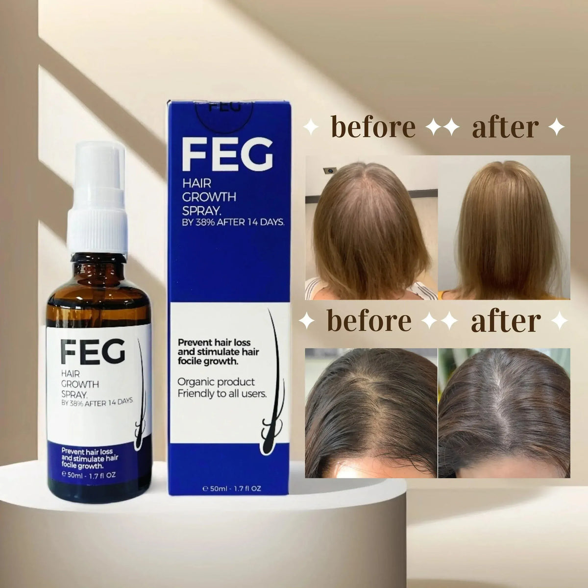 FEG PLUS Hair & Beard Regrowth Spray – Anti Hair Loss Formula With Minoxidil, Redensyl & Natural Extracts (50ml)
