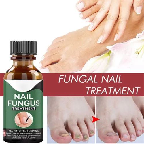 Fast Nail Fungus Treatment Gel – Nail Repair Essence Serum For Healthy, Smooth & Strong Nails