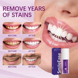 Teeth Brightening Hismiles V34 Colour Corrector Serum - 30ml | Hismile For Teeth Brightening