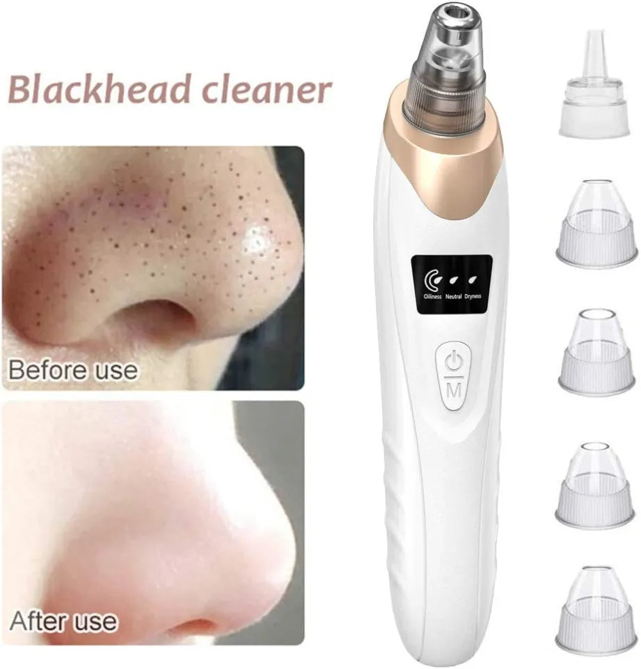 5in1 Blackhead Remover Machine Rechargeable | Face Vacuum Derma Suction With 5 Heads | Blackhead Removing Machine