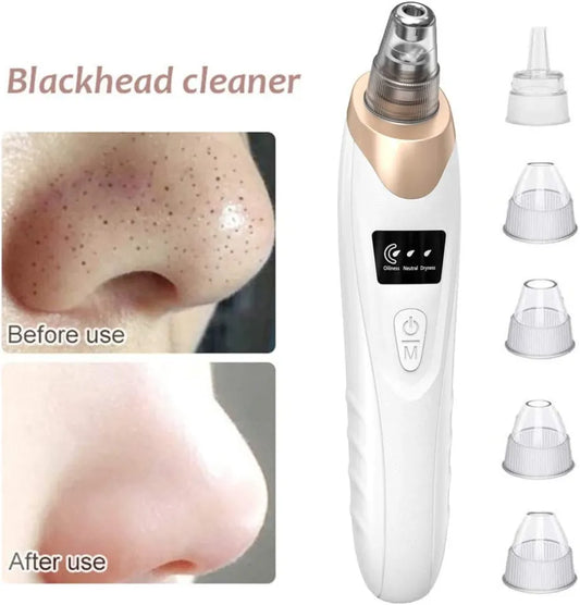 5in1 Blackhead Remover Machine Rechargeable | Face Vacuum Derma Suction With 5 Heads | Blackhead Removing Machine