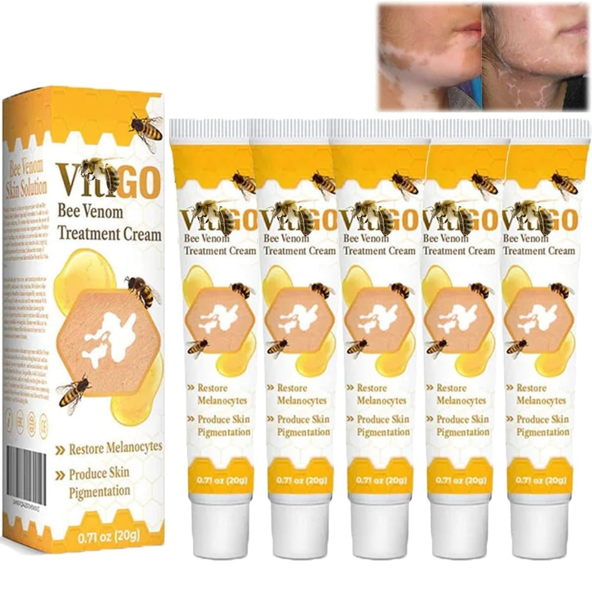 Fivfivgo™ VitiGO Bee Venom Correcting Cream (20g) Support For Skin Pigmentation Recovery And Even Skin Tone
