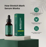 Markaway Advanced Stretch Mark Serum – Clinic-Tested Formula For Prevention & Fading | Retinol, Hydroquinone, & AHA/BHA-Free