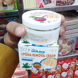 South Moon Lipoma Removal And Body Smoothing Cream 50g Herbal Natural Lump And Skin Knot Relief Ointment