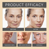 Botox Bee Venom Whitening & Moisturizing Cream – Anti-Aging, Brightening & Skin Firming Facial Care (50g)