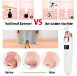 5in1 Blackhead Remover Machine Rechargeable | Face Vacuum Derma Suction With 5 Heads | Blackhead Removing Machine