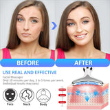 ES-1081 Massager Intense Pulsed Light Wrinkles Reducing Instrument - ESX - Anti Ageing & Reduces Puffiness | Face Massager For Fine Line & Wrinkles - Random Color